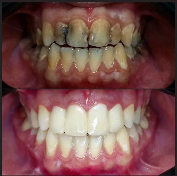 مركز الدكتور لؤي عوض لتجميل وزراعة الاسنان