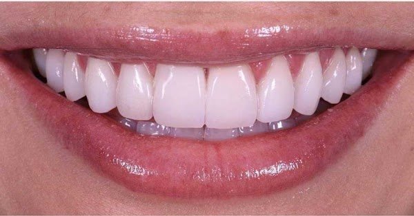 عيادة الدكتورة رولا عبد الهادي خصيب لطب الأسنان