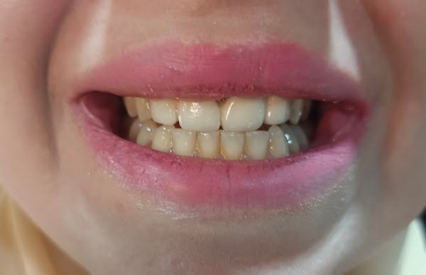 عيادة الدكتور سامر نزيه المزيك /طب اسنان