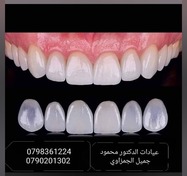 عيادة اسنان الدكتور محمود جميل الجمزاوي طبيب تجميل زراعة تقويم تركيب