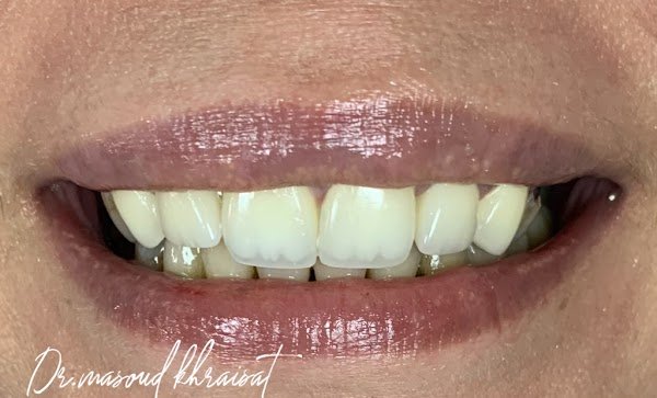 Shine Dental Clinic